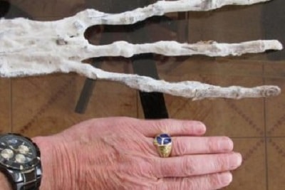 Странная находка в Перу: рука с тремя длинными пальцами