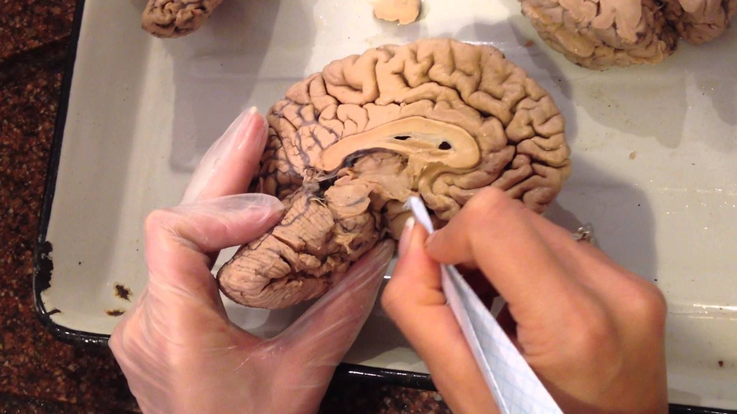 Откуда у человека появился мозг