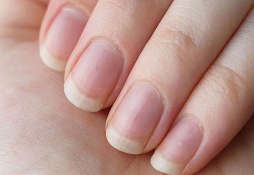 Что ногти могут рассказать о вашем здоровье