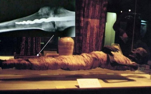 Медицинская загадка древней мумии